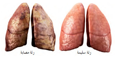 أسباب الإصابة بالسرطان