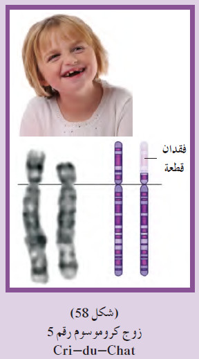 الأمراض الناتجة من خلل في بنية وتركيبة الكروموسومات